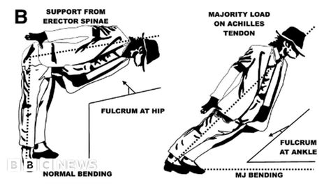 Doctors explain Michael Jackson's impossible dance .